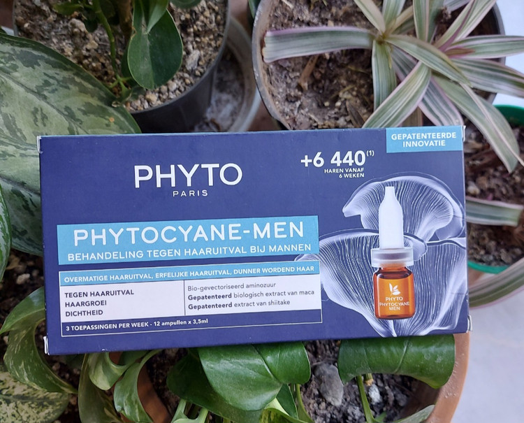 ریزش مو هورمونی و ژنتیکی مخصوص آقایان